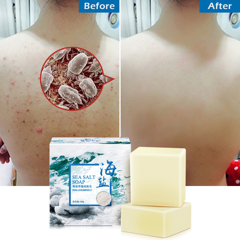 Sea Salt Cleaner oil control Anti acne treatment body Soap